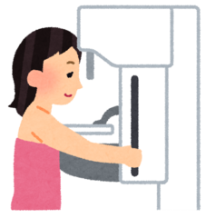 イラスト:乳房エックス線撮影の様子